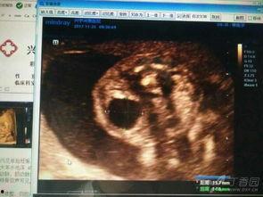 怀孕23周视频,宝宝成长里程碑与妈妈健康指南