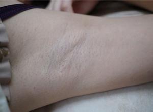 脱阴毛的视频,安全、舒适，告别尴尬