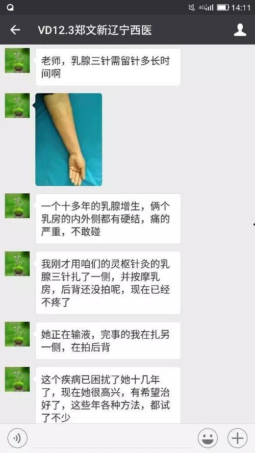 针灸的视频教程
